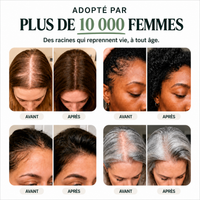 Barre Capillaire Coréenne